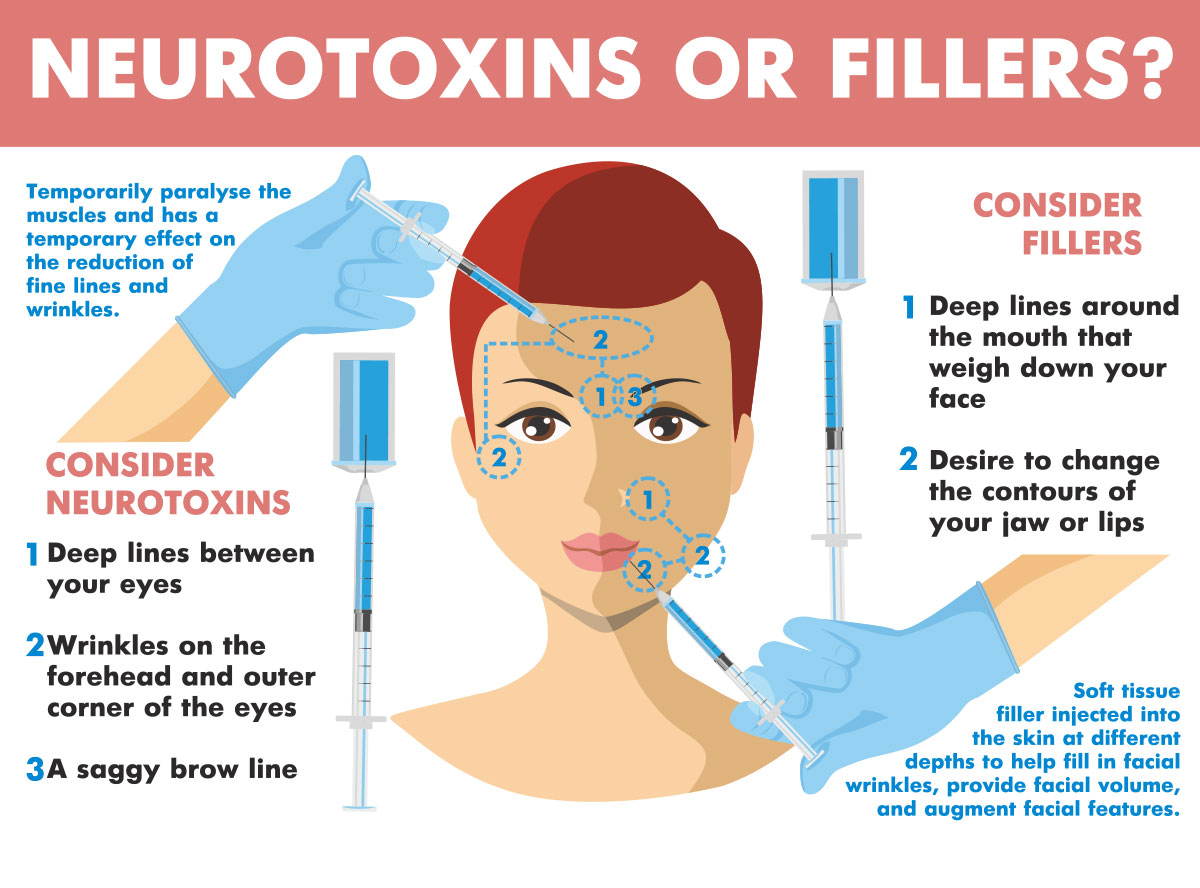 The diagram seeks to illustrate the differences between Botox & fillers. Popular examples of fillers are: Restylane, Juvederm, Belotero (hyaluronic acid), Radiesse (Calcium Hydroxylapatite), Sculptra (Poly-L-lactic Acid). The diagram also describes the intended effect for Botox and fillers, how each product works and where they are to be used.  